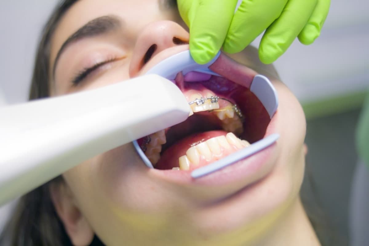 Dentista atendiendo a un paciente en el consultorio
